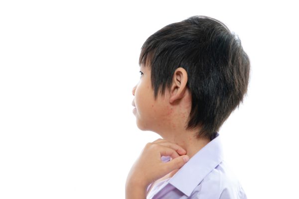 Asian,Boy,Screatching,His,Neck,With,Rash,On,White,Background